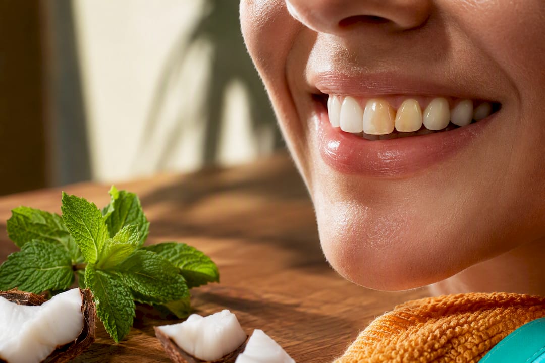 Close-up smile showing subtle tooth surface staining