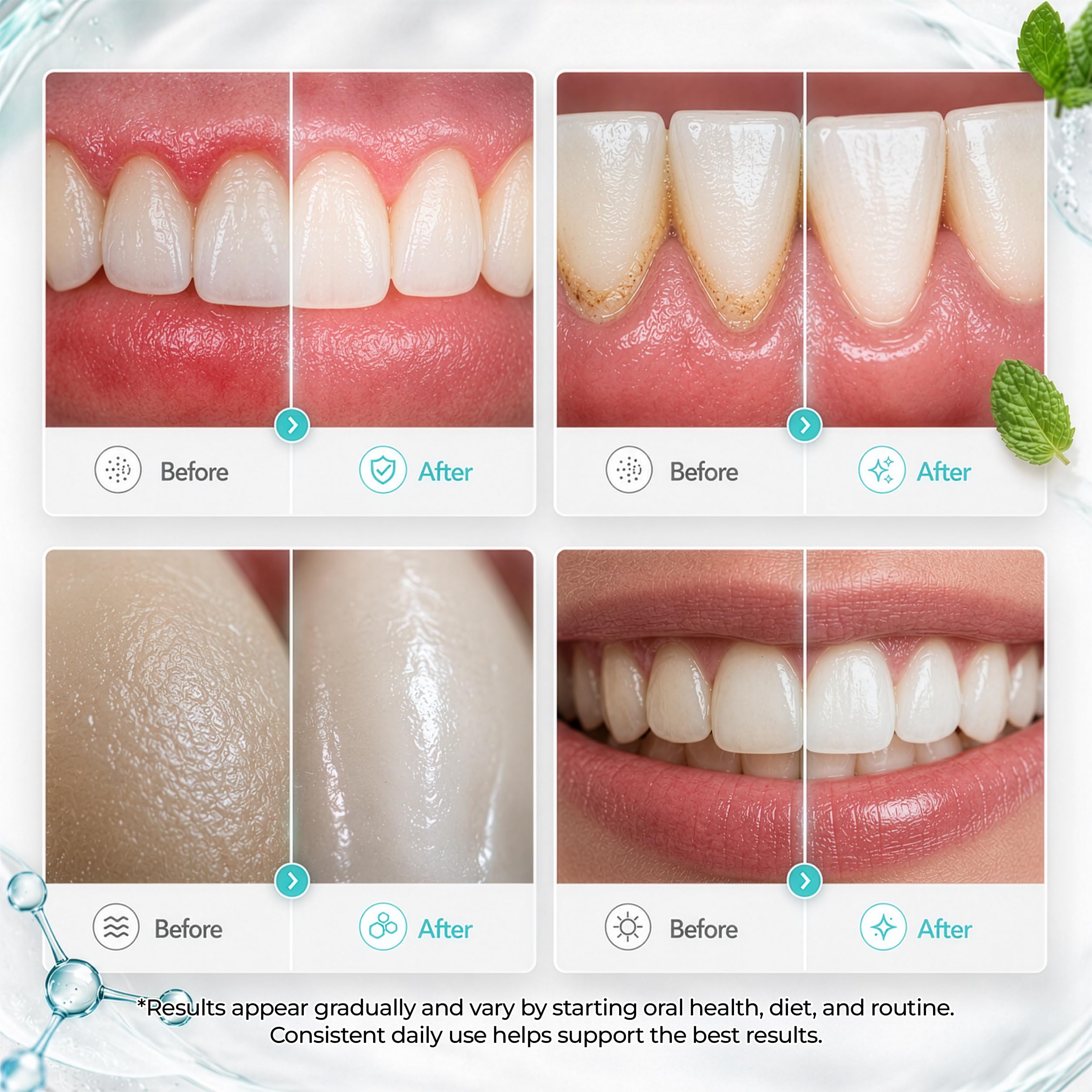 Oral care before-and-after comparison graphic for SELFWISE xylitol mouthwash